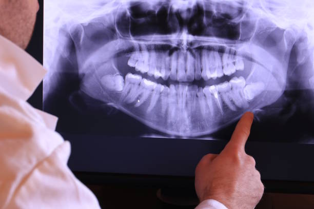 Best Dentist for Tooth Abscess  in Delhi Hills, OH