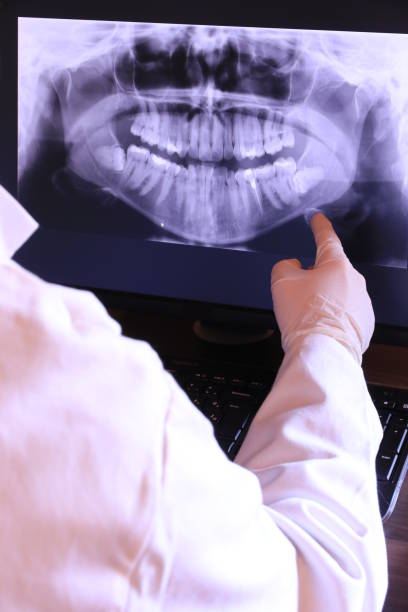 Best Knocked-Out Tooth Emergency  in Delhi Hills, OH