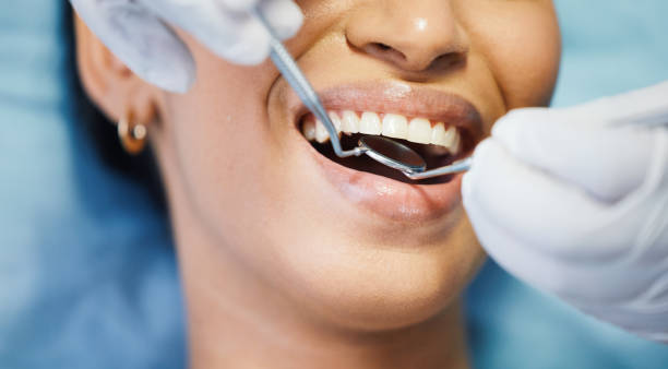 Best Emergency Gum Pain Relief  in Delhi Hills, OH